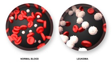 白血病-vs-正常的血液