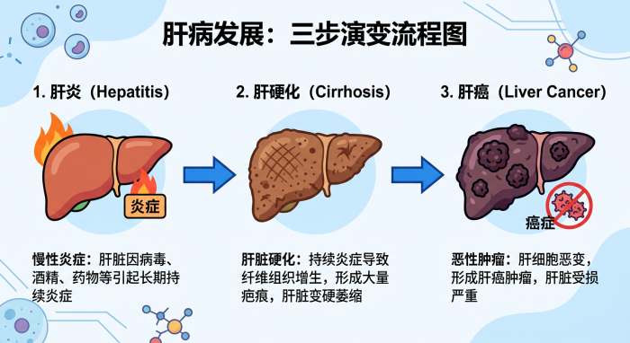 肝癌三步