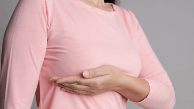 乳腺癌