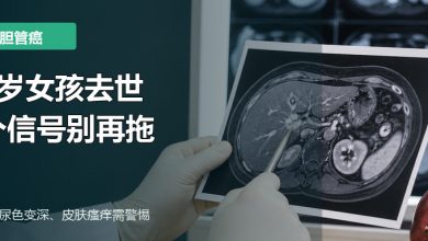 胆管癌早期信号